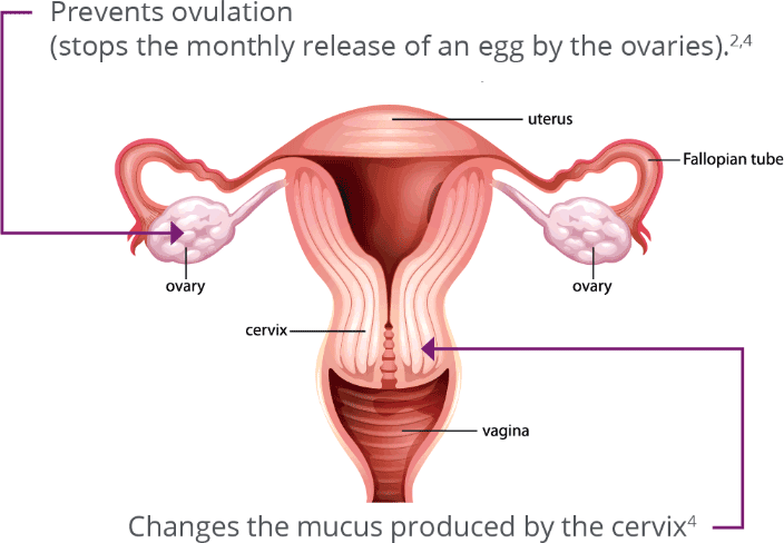 Prevent ovulation (stops the monthly release of an egg by the ovaries).2,4 Changes the mucous produced by the cervix4